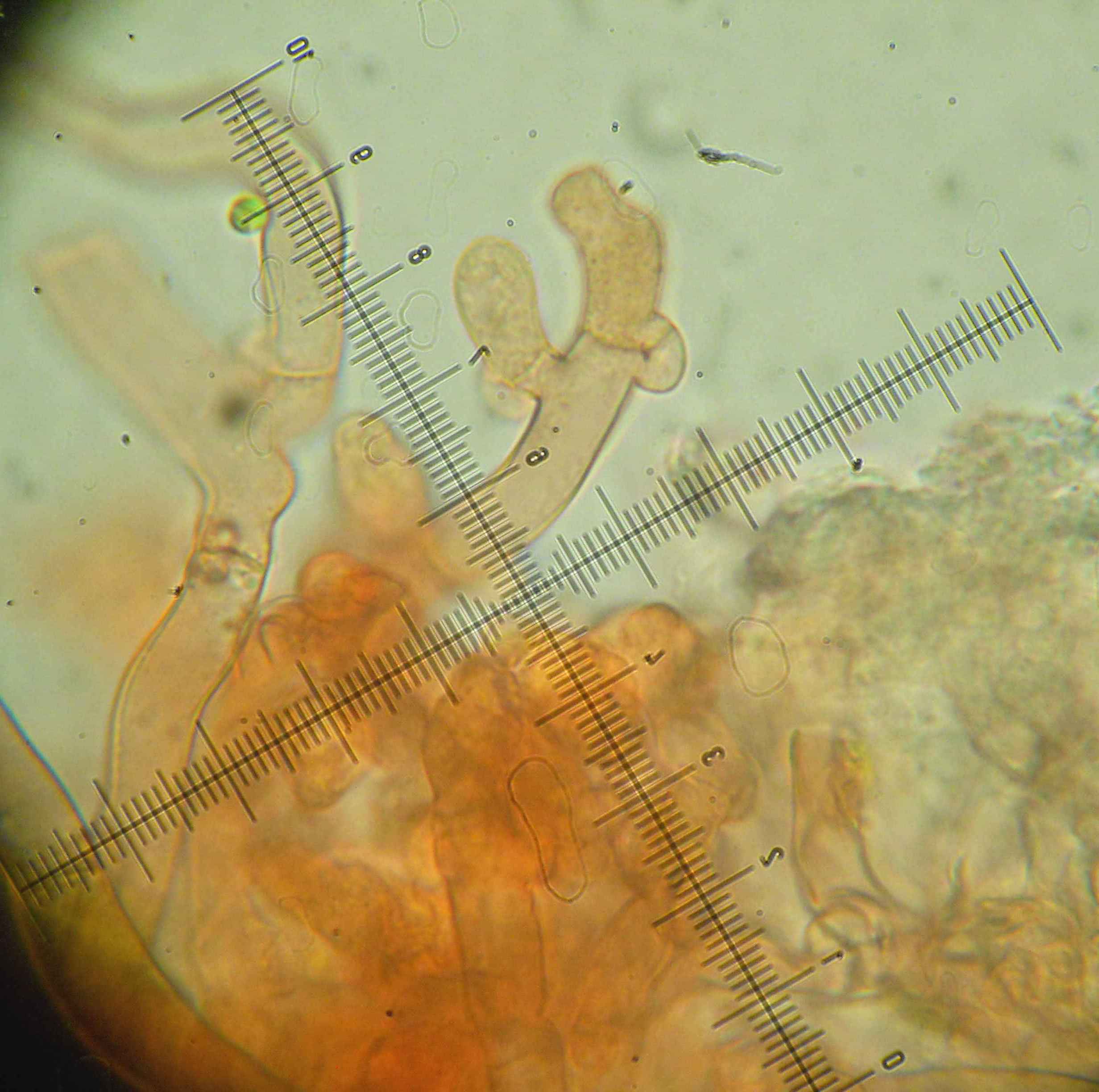 Botryobasidium? (Botryobasidium subcoronatum)